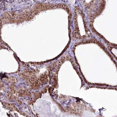 Immunohistochemistry-Paraffin: RSBN1 Antibody [NBP1-83765]