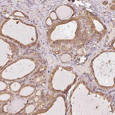 Immunohistochemistry-Paraffin: RSBN1 Antibody [NBP2-48936]