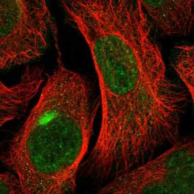 Immunocytochemistry/ Immunofluorescence: RSBN1L Antibody [NBP1-81903]