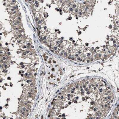 Immunohistochemistry: RSBN1L Antibody [NBP1-81902]