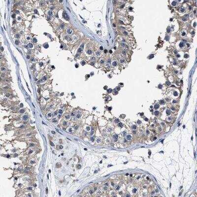 Immunohistochemistry: RSBN1L Antibody [NBP1-81903]
