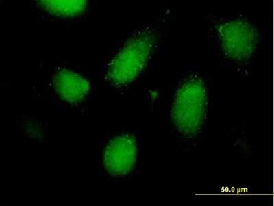 Immunocytochemistry/ Immunofluorescence: RSC1A1 Antibody [H00006248-B01P]