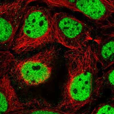 Immunocytochemistry/ Immunofluorescence: RSF1 Antibody [NBP2-57248]