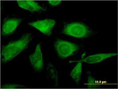 Immunocytochemistry/ Immunofluorescence: RSG1 Antibody (3G4) [H00079363-M02]