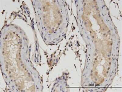 Immunohistochemistry-Paraffin: RSG1 Antibody (3G4) [H00079363-M02]