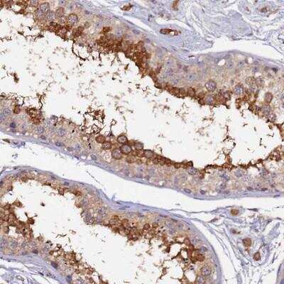 Immunohistochemistry-Paraffin: RSHL1 Antibody [NBP1-92356]