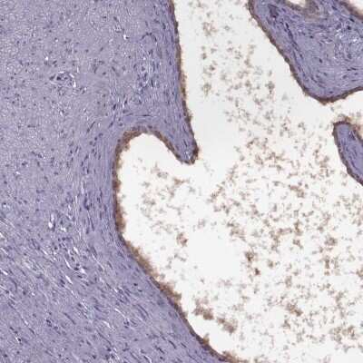 Immunohistochemistry-Paraffin: RSHL1 Antibody [NBP1-92356]