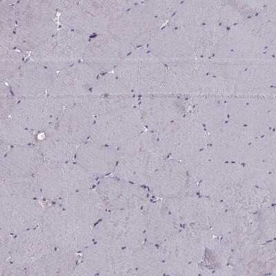 Immunohistochemistry-Paraffin: RSHL1 Antibody [NBP1-92356]