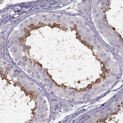 Immunohistochemistry-Paraffin: RSHL1 Antibody [NBP1-92356]