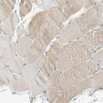 Immunohistochemistry-Paraffin: RSK1 Antibody [NBP1-89647]