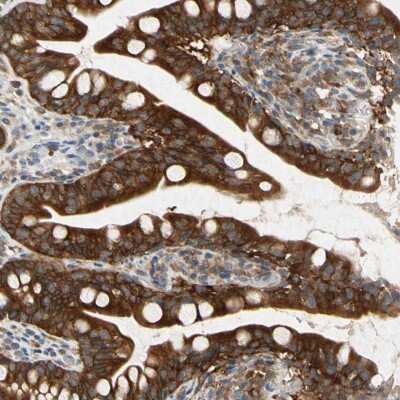 Immunohistochemistry-Paraffin: RSK1 Antibody [NBP1-89647]
