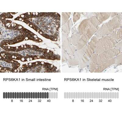Immunohistochemistry-Paraffin: RSK1 Antibody [NBP1-89647]