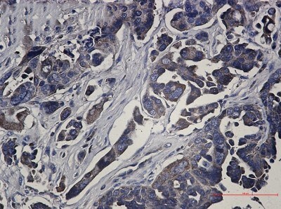 Immunohistochemistry-Paraffin: RSK1 Antibody (S02-2D2) [NBP3-20053]