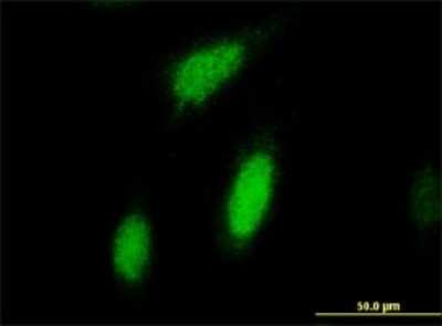 Immunocytochemistry/ Immunofluorescence: RSK2 Antibody (2G10) [H00006197-M01]