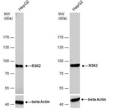 Western Blot: RSK2 Antibody [NBP2-20236]