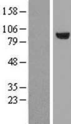 Western Blot: RSK2 Overexpression Lysate [NBP2-10528]