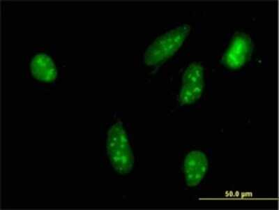 Immunocytochemistry/ Immunofluorescence: RSK3 Antibody (1F6) [H00006196-M01]