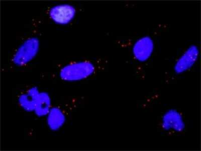 Proximity Ligation Assay: RSK3 Antibody (1F6) [H00006196-M01]