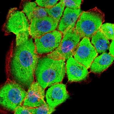 Immunocytochemistry/ Immunofluorescence: RSK3 Antibody (3C4C8) - BSA Free [NBP2-52555]
