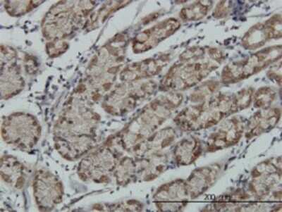 Immunohistochemistry-Paraffin: RSK4 Antibody (6F2) [H00027330-M02]