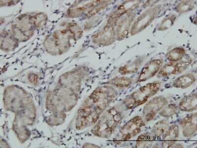 Immunohistochemistry-Paraffin: RSK4 Antibody (8E8) [H00027330-M04]