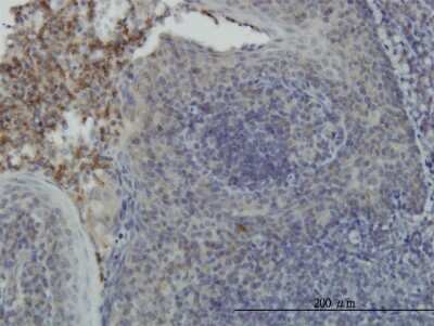 Immunohistochemistry-Paraffin: RSK4 Antibody (8H5) [H00027330-M03]