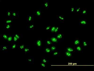 Immunocytochemistry/ Immunofluorescence: RSL1D1 Antibody [H00026156-B01P]