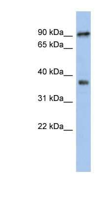 Western Blot: RSPH10B Antibody [NBP1-56466]