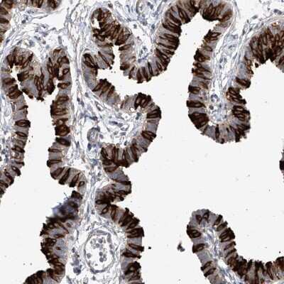 Immunohistochemistry-Paraffin: RSPH4A Antibody [NBP1-90572]