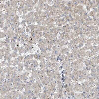 Immunohistochemistry-Paraffin: RSPH4A Antibody [NBP1-90572]