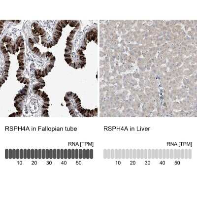 Immunohistochemistry-Paraffin: RSPH4A Antibody [NBP1-90572]