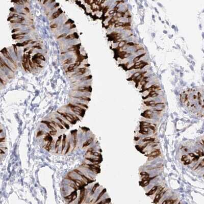 Immunohistochemistry-Paraffin: RSPH4A Antibody [NBP1-90573]