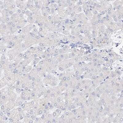 Immunohistochemistry-Paraffin: RSPH4A Antibody [NBP1-90573]