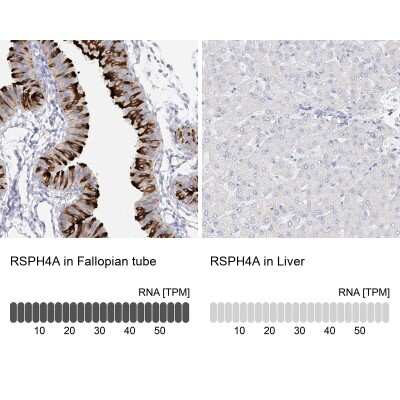 Immunohistochemistry-Paraffin: RSPH4A Antibody [NBP1-90573]