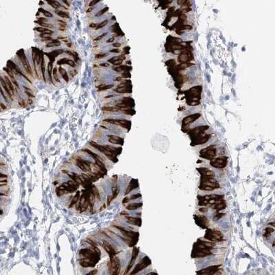 Immunohistochemistry-Paraffin: RSPH4A Antibody [NBP1-90574]