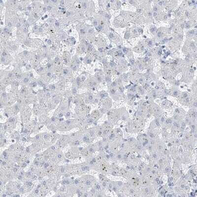 Immunohistochemistry-Paraffin: RSPH4A Antibody [NBP1-90574]