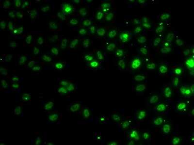 Immunocytochemistry/ Immunofluorescence: RSRC1 Antibody - BSA Free [NBP2-93020]