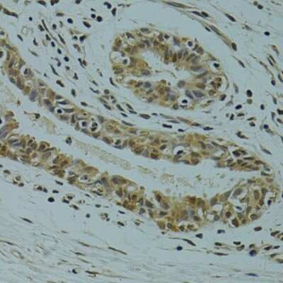Immunohistochemistry-Paraffin: RSRC1 Antibody - BSA Free [NBP2-93020]