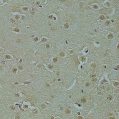 Immunohistochemistry-Paraffin: RSRC1 Antibody - BSA Free [NBP2-93020]