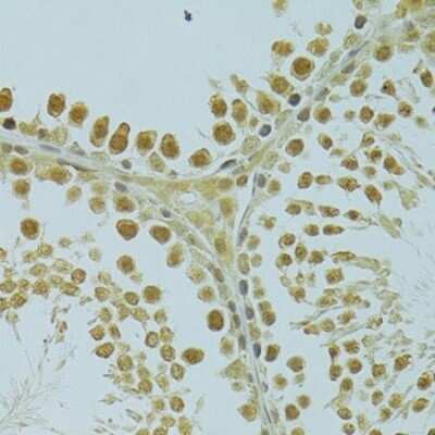 Immunohistochemistry-Paraffin: RSRC1 Antibody - BSA Free [NBP2-93020]