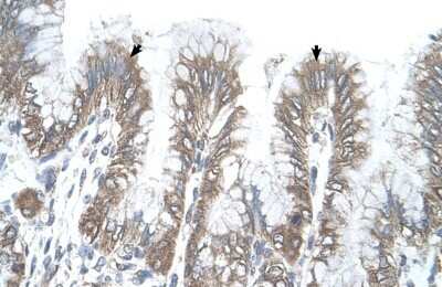Immunohistochemistry-Paraffin: RSRC2 Antibody [NBP1-54332]