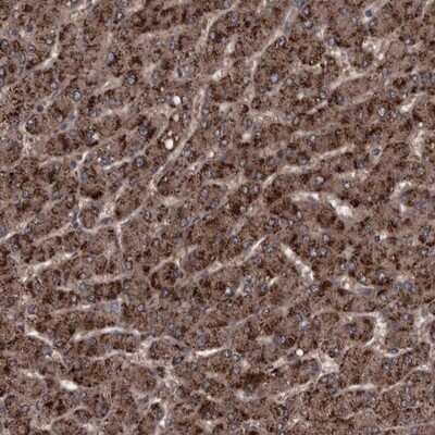 Immunohistochemistry-Paraffin: RSU1 Antibody [NBP1-82029]