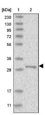 Western Blot: RSU1 Antibody [NBP1-82029]
