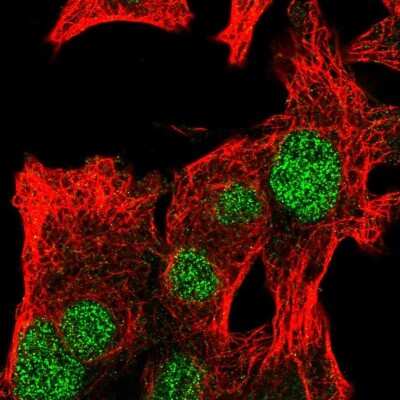 Immunocytochemistry/ Immunofluorescence: RTCD1 Antibody [NBP2-58714]