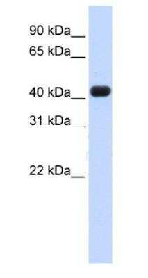 Western Blot: RTCD1 Antibody [NBP1-57245]