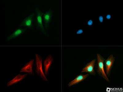 Immunocytochemistry/ Immunofluorescence: RTEL1 Antibody - BSA Free [NBP2-22360]
