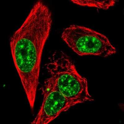 Immunocytochemistry/ Immunofluorescence: RTEL1 Antibody [NBP2-68595]
