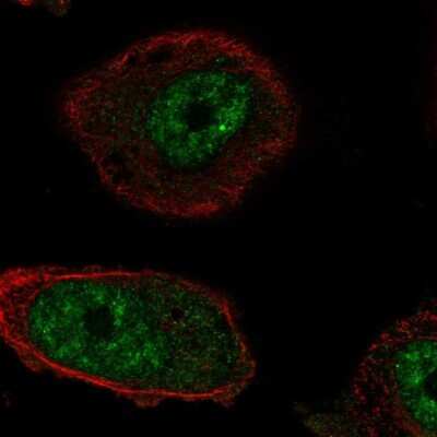 Immunocytochemistry/ Immunofluorescence: RTEL1 Antibody [NBP2-69067]