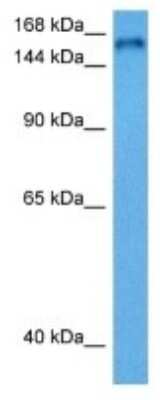 Western Blot: RTEL1 Antibody [NBP3-10036]