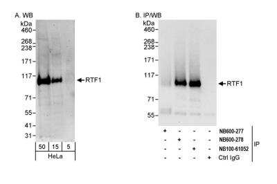 Western Blot: RTF1 Antibody [NB600-277]